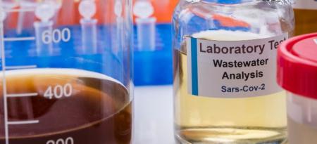 Agua residual en un laboratorio para rastrear si tiene restos de Sars-Cov-2.
